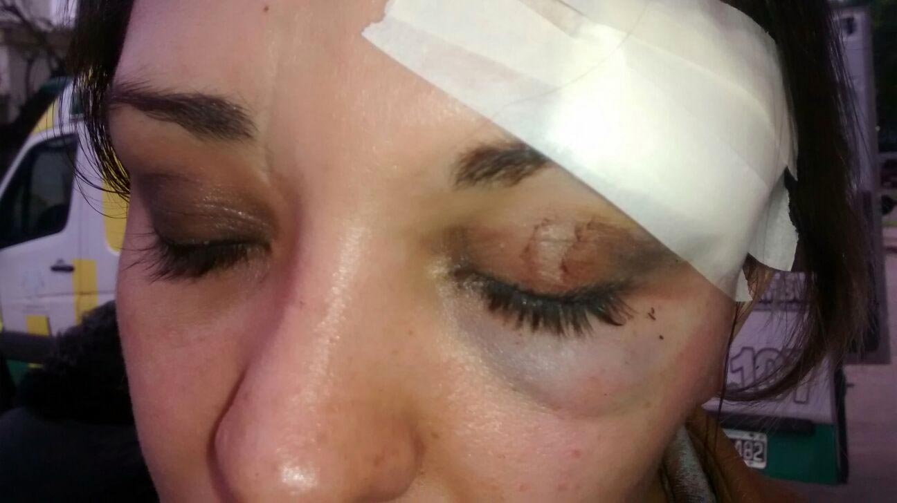 Dos jóvenes denunciaron la agresión de patovicas de Zeta