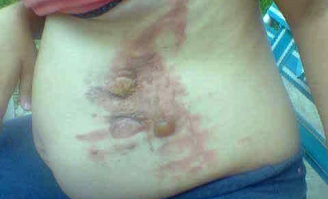 Sexagenaria que arrojó agua caliente a su vecina embarazada, recuperó la libertad