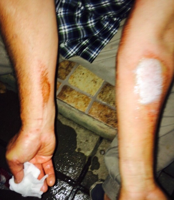 3 en 1: camioneta se metió en un garage; Pitty Torres lesionado y Cherñac internado