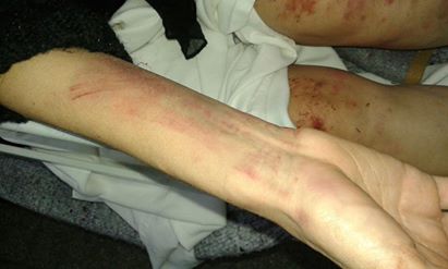 Violencia de género: denuncian golpiza de un hombre contra su pareja