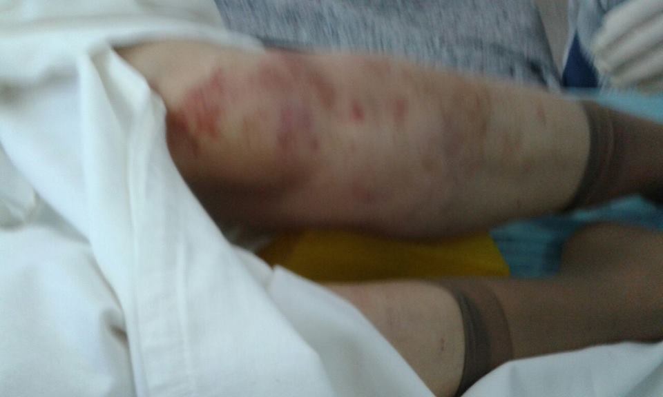 Violencia de género: denuncian golpiza de un hombre contra su pareja