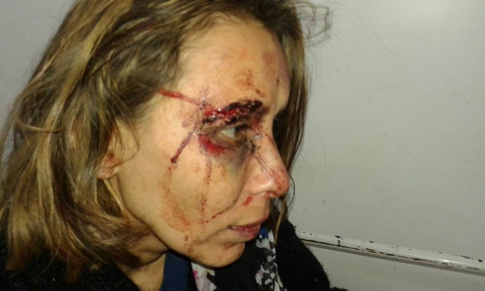 Violencia de género: denuncian golpiza de un hombre contra su pareja