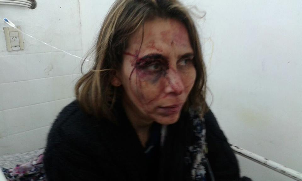 Violencia de género: denuncian golpiza de un hombre contra su pareja