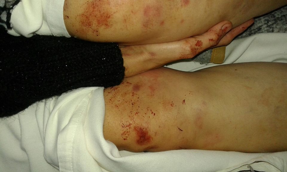 Violencia de género: denuncian golpiza de un hombre contra su pareja