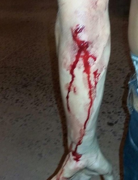Fotos difundidas en redes sociales.
