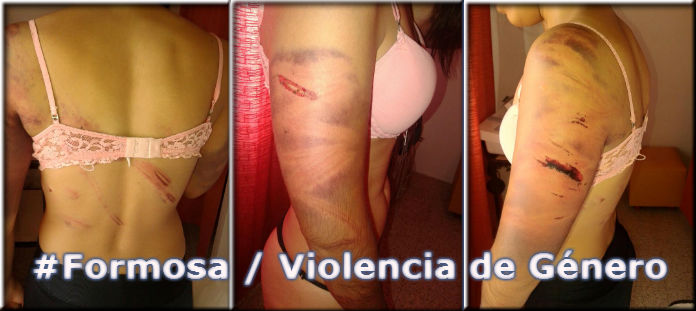 violencia de genero nf tapa