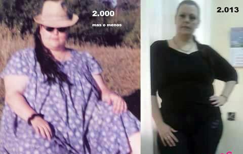 «Historia de mi lucha contra la obesidad», el testimonio y ejemplo de Sandra