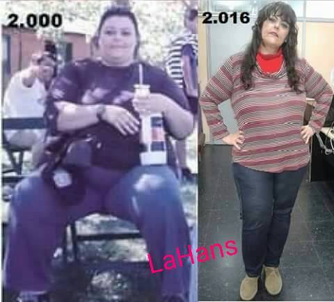 «Historia de mi lucha contra la obesidad», el testimonio y ejemplo de Sandra