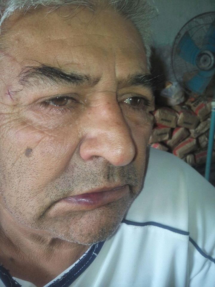 #RelatosSalvajes / Por una pelea de perros, un hombre golpeó a otro que terminó internado por un ACV