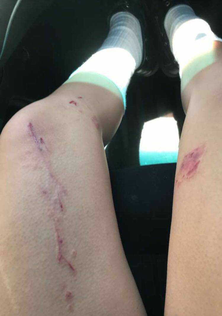 Festejo de egresadas del Santa Isabel terminó en el hospital