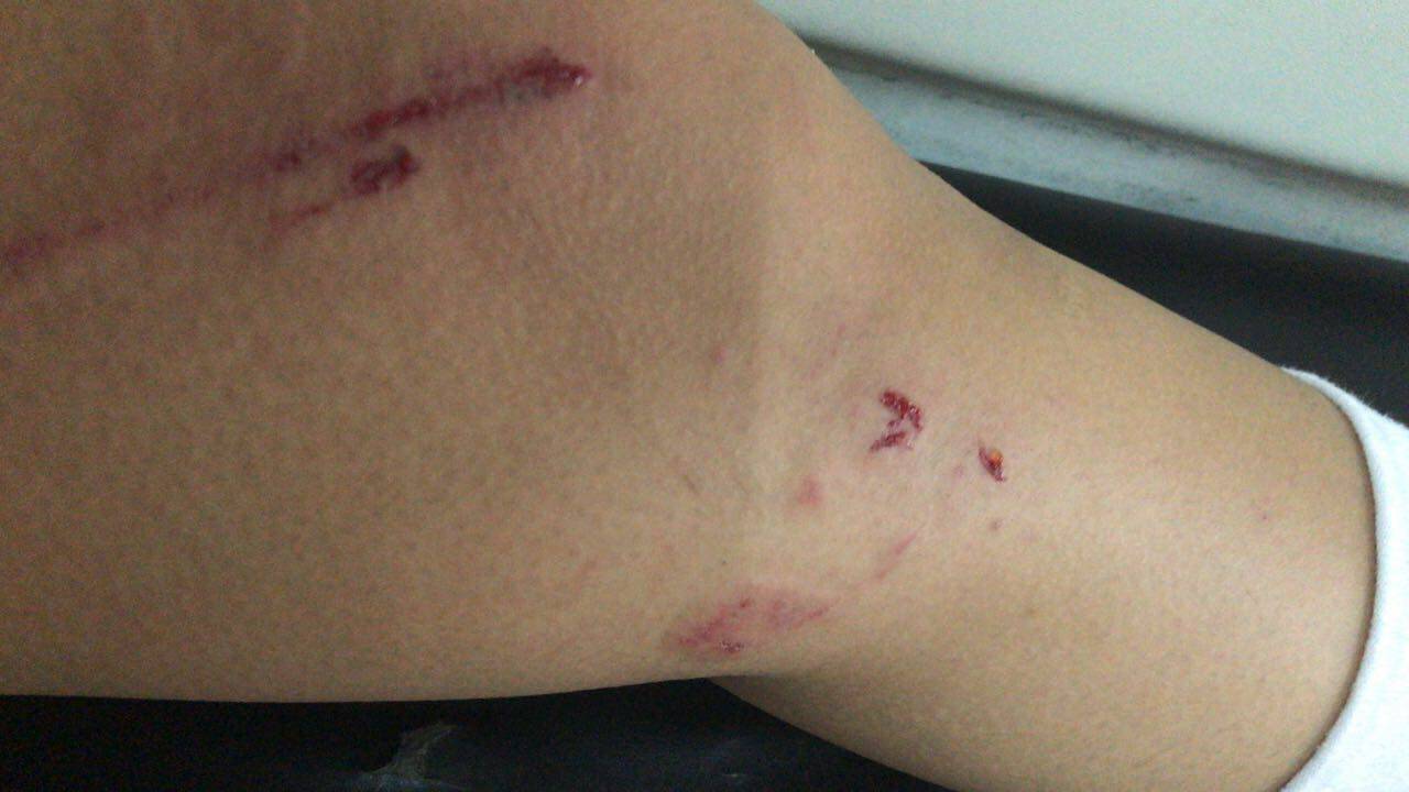 Festejo de egresadas del Santa Isabel terminó en el hospital