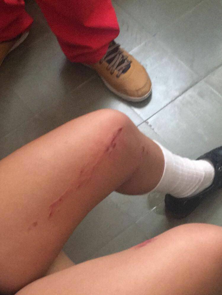 Festejo de egresadas del Santa Isabel terminó en el hospital