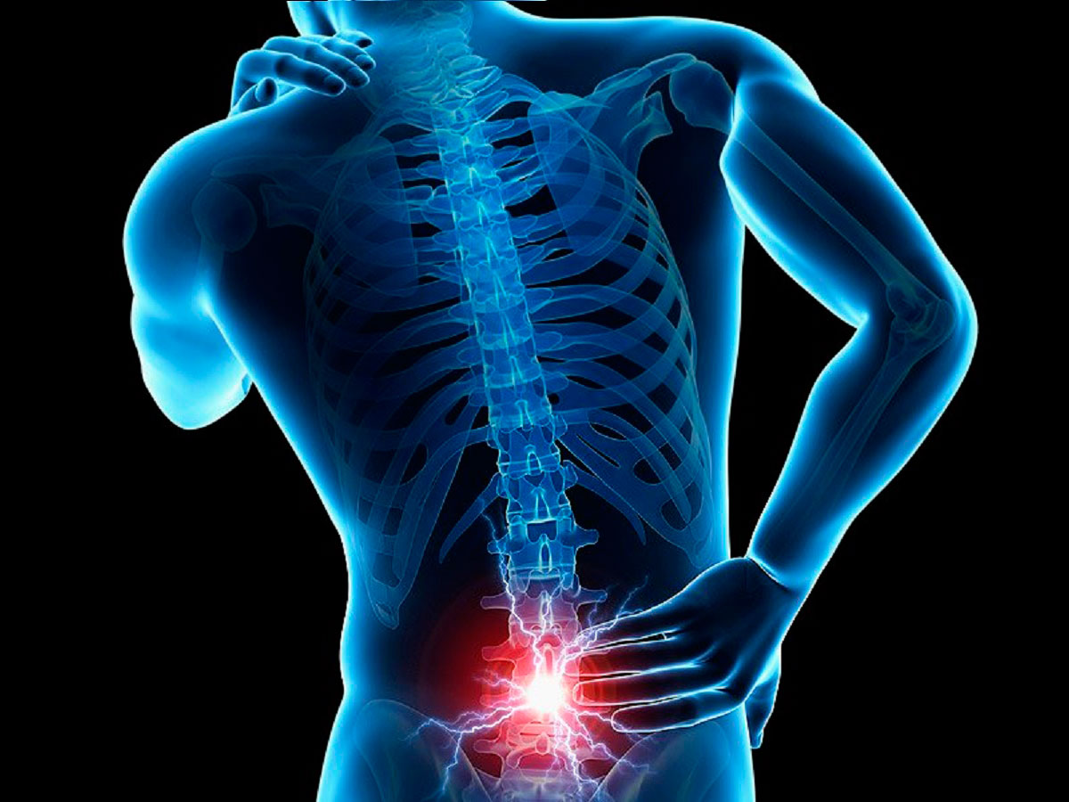El 80 % de los adultos padece dolor en la espalda baja, una lesión