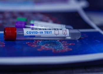 Dos hisopados positivos más elevan el total a 101 casos diagnosticados en Formosa