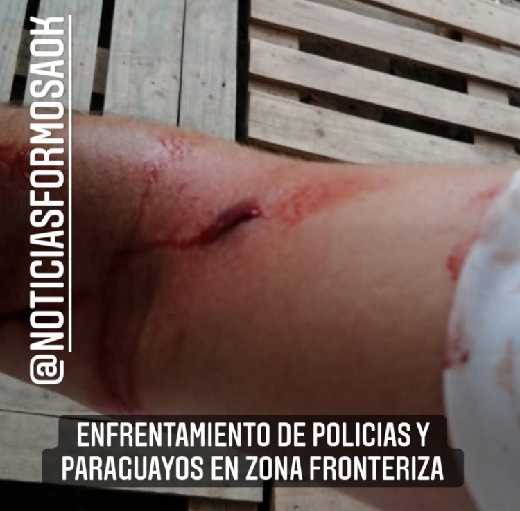 Varios policías heridos en enfrentamientos en los barrios limítrofes con Paraguay por contrabando