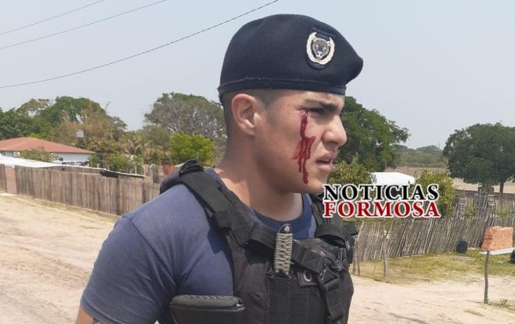 Varios policías heridos en enfrentamientos en los barrios limítrofes con Paraguay por contrabando