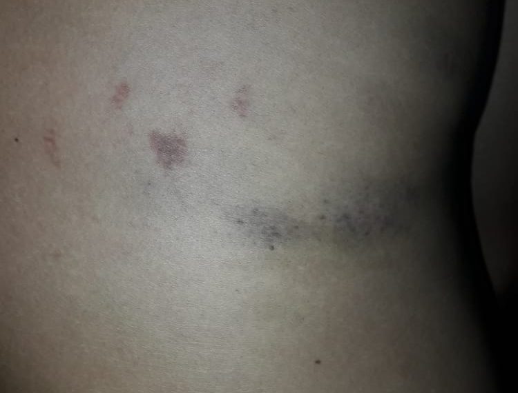 Denuncian a la Policía de Ibarreta por apremios ilegales a un joven