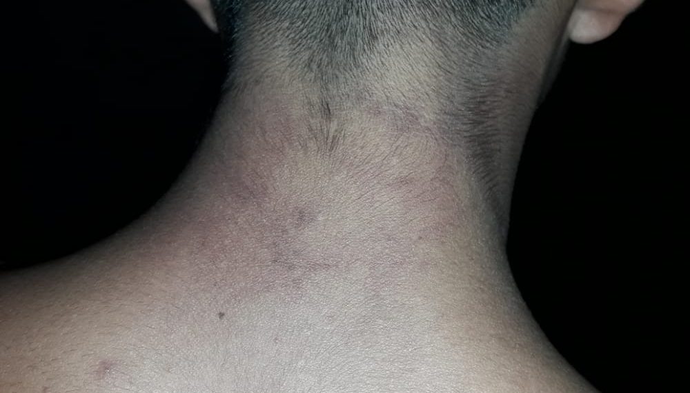 Denuncian a la Policía de Ibarreta por apremios ilegales a un joven