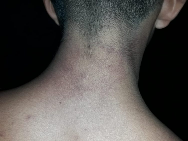 Denuncian a la Policía de Ibarreta por apremios ilegales a un joven