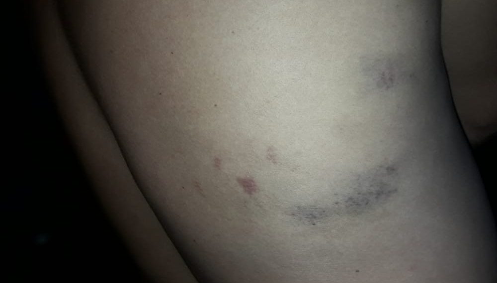 Denuncian a la Policía de Ibarreta por apremios ilegales a un joven