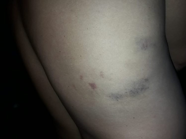 Denuncian a la Policía de Ibarreta por apremios ilegales a un joven