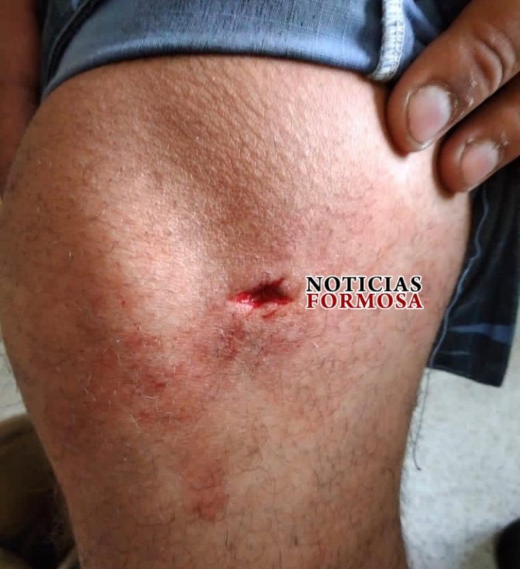 Contrabandistas paraguayos agredieron a diez policías formoseños