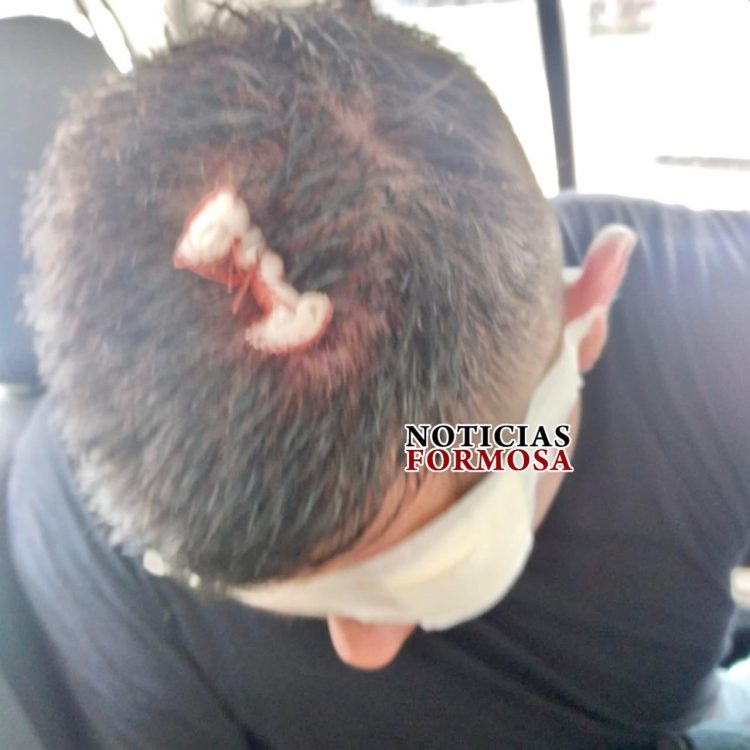 Contrabandistas paraguayos agredieron a diez policías formoseños