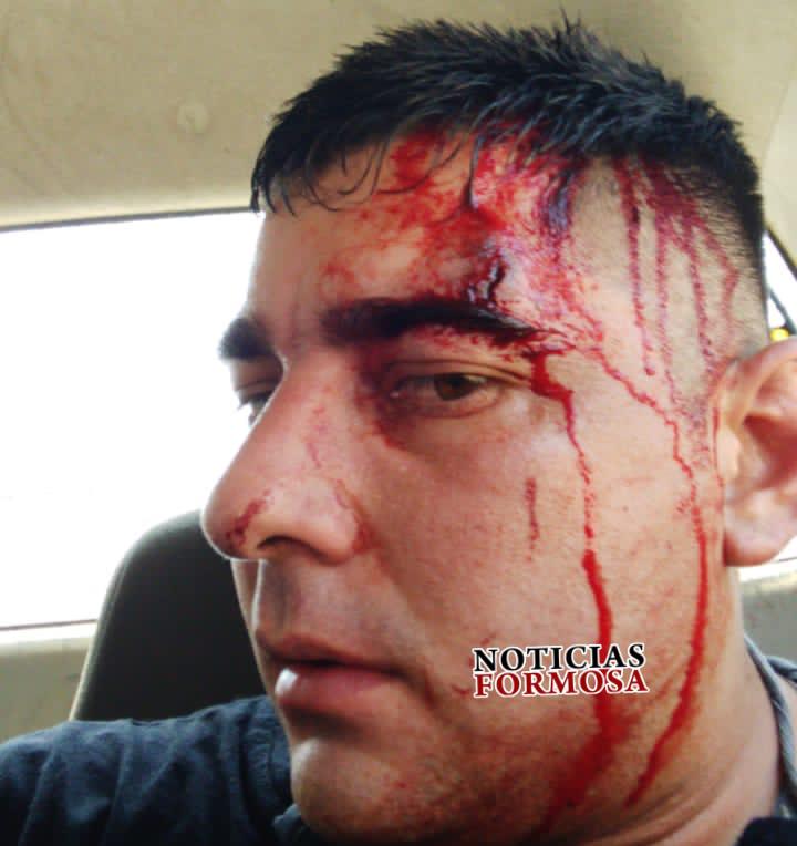 Contrabandistas paraguayos agredieron a diez policías formoseños