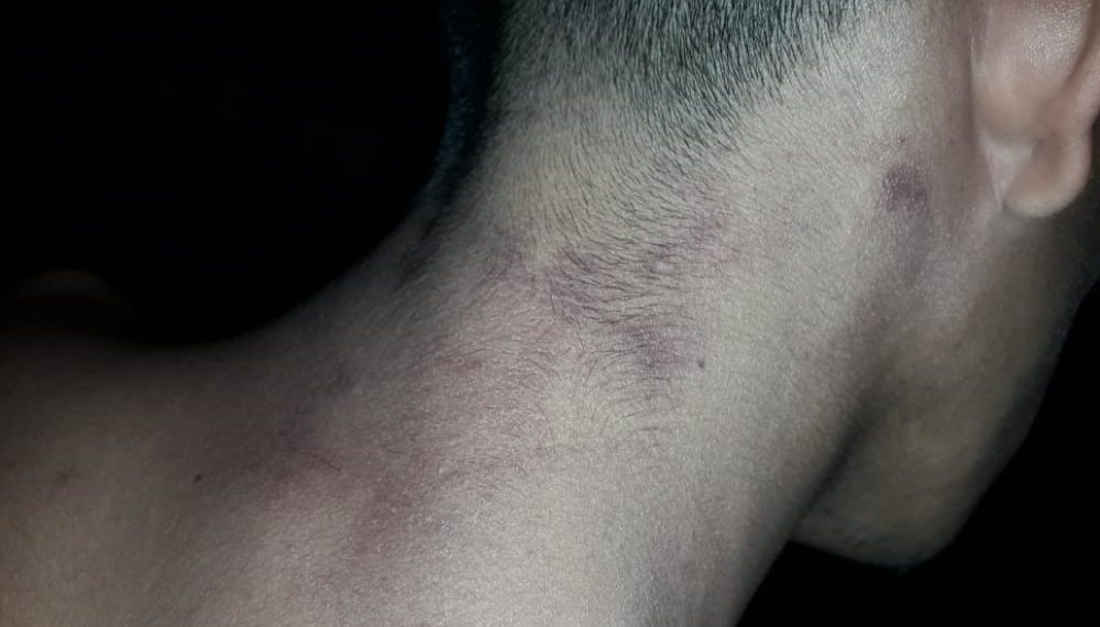 Denuncian a la Policía de Ibarreta por apremios ilegales a un joven