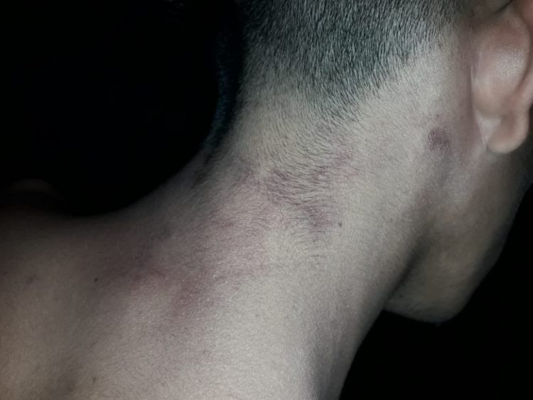 Denuncian a la Policía de Ibarreta por apremios ilegales a un joven