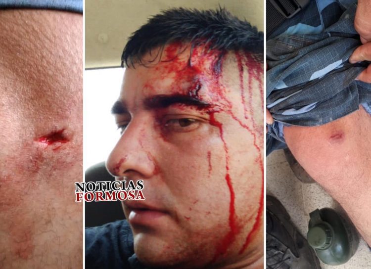 Contrabandistas paraguayos agredieron a diez policías formoseños