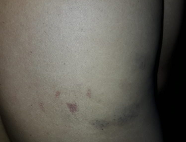 Denuncian a la Policía de Ibarreta por apremios ilegales a un joven