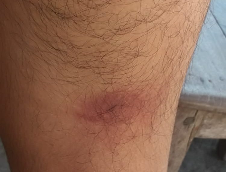 Denuncian a la Policía de Ibarreta por apremios ilegales a un joven