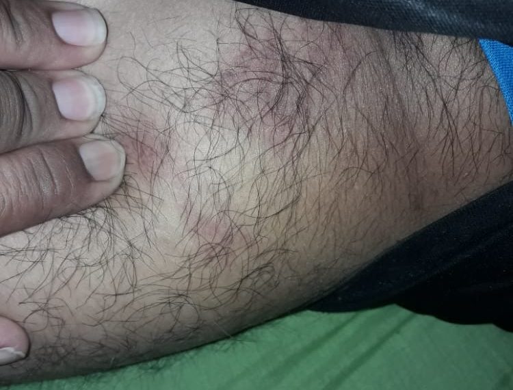 Denuncian a la Policía de Ibarreta por apremios ilegales a un joven