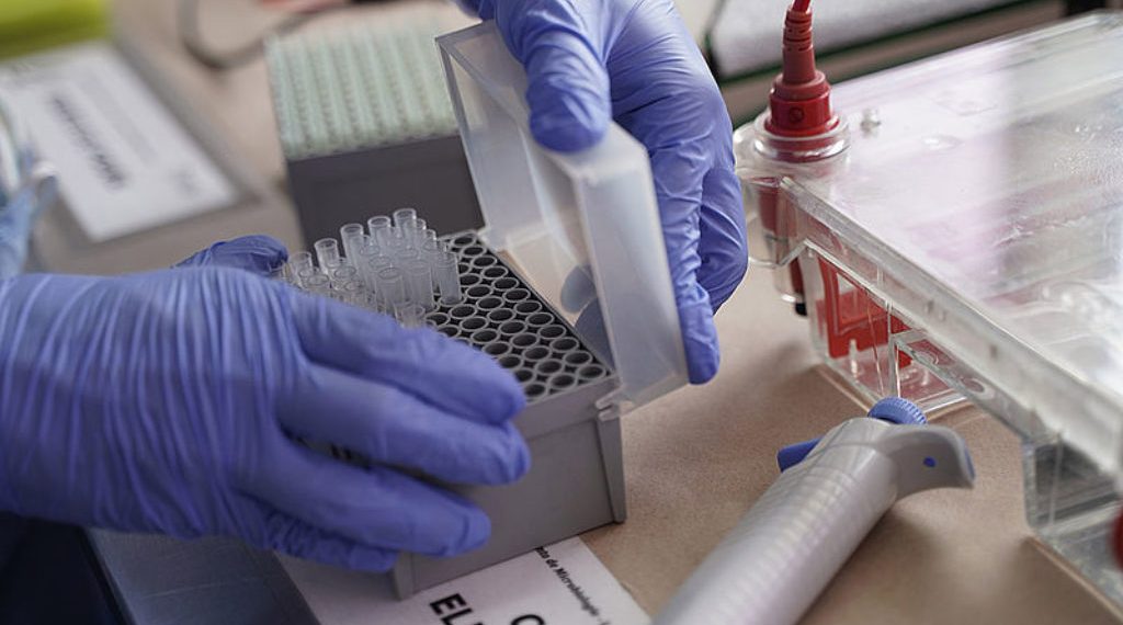 Laboratorio Barros autorizado para hisopar