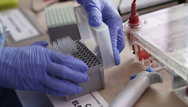 Laboratorio Barros autorizado para hisopar