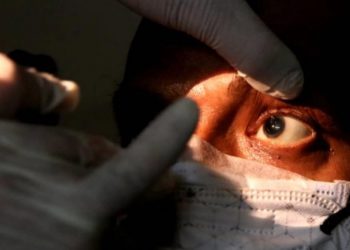 Caso formoseño de “hongo negro” transitó en un centro de aislamiento