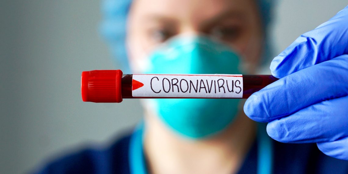 Tres decesos y 289 contagios confirmados es el balance epidemiológico del lunes