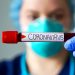 Tres decesos y 289 contagios confirmados es el balance epidemiológico del lunes