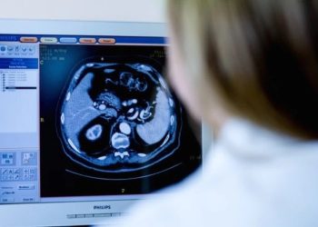 A partir de qué edad y por qué es necesario el chequeo anual de próstata