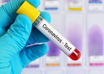 Covid: Sin casos positivos, decesos, ni altas médicas