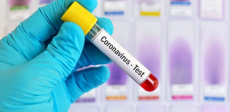 Covid: Sin casos positivos, decesos, ni altas médicas