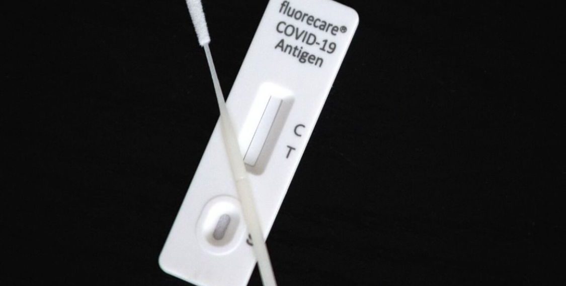 Llegan los autotest covid a las farmacias: costará $ 1.560