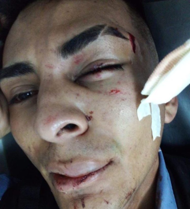 Noche de furia: atacaron a policías y embistieron con su auto a un patrullero