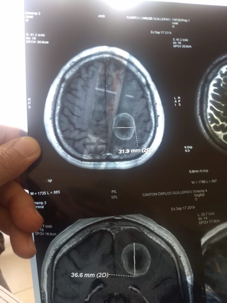«La vida me dio otra oportunidad»