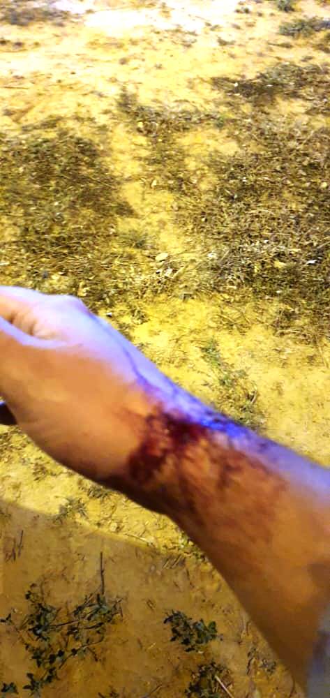 Nuevo capítulo de violencia en el oeste: otro enfrentamiento entre policías y aborígenes