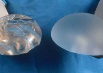 Advierten que los implantes mamarios pueden vincularse a otros tipos de cáncer