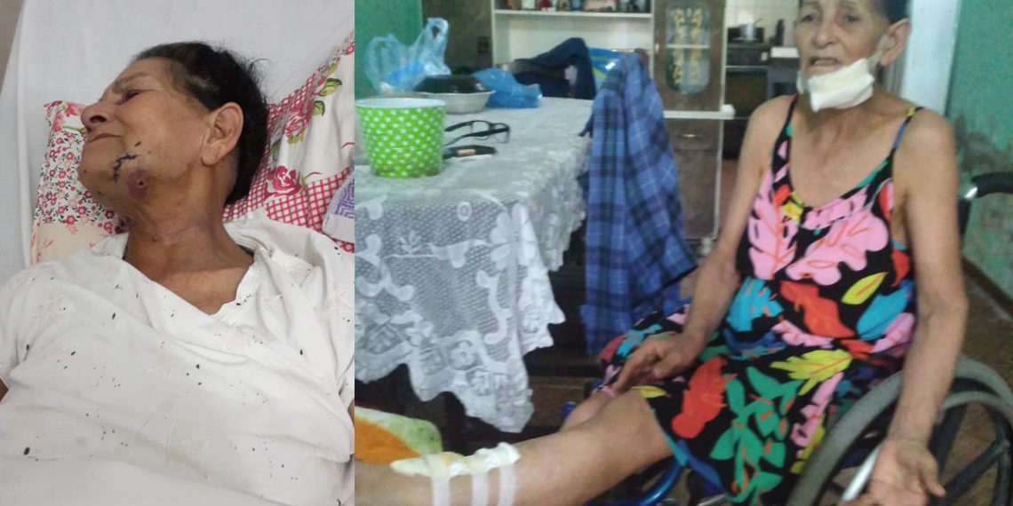 Terrible ataque de un pitbull a una mujer