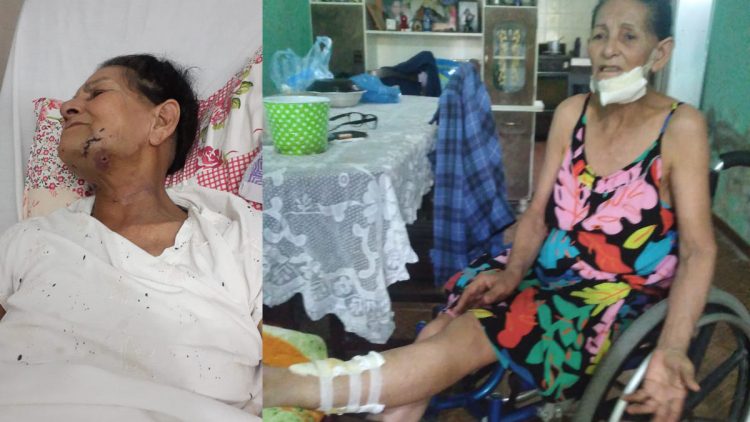 Terrible ataque de un pitbull a una mujer