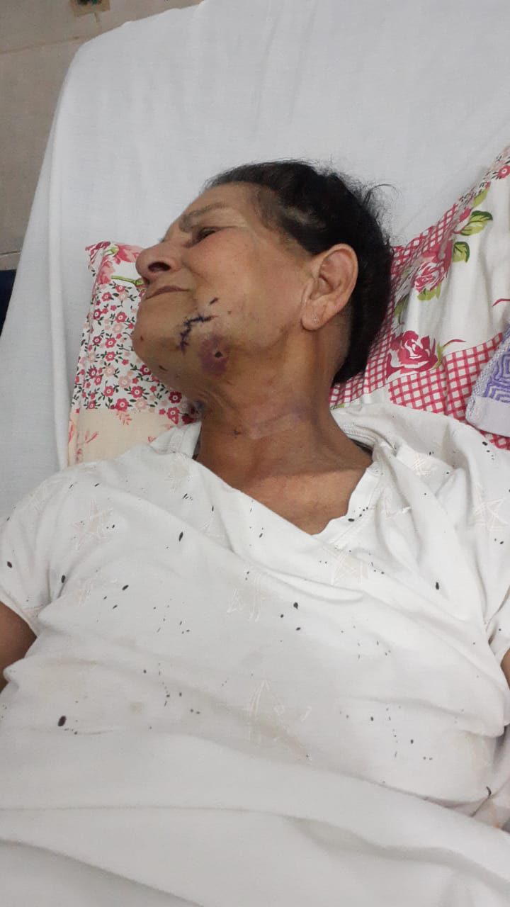 Terrible ataque de un pitbull a una mujer